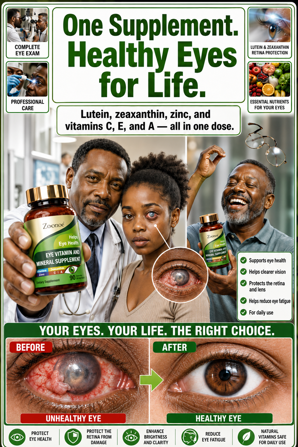 Eye Vitamin : Lutein and Zeaxanthin Supplements